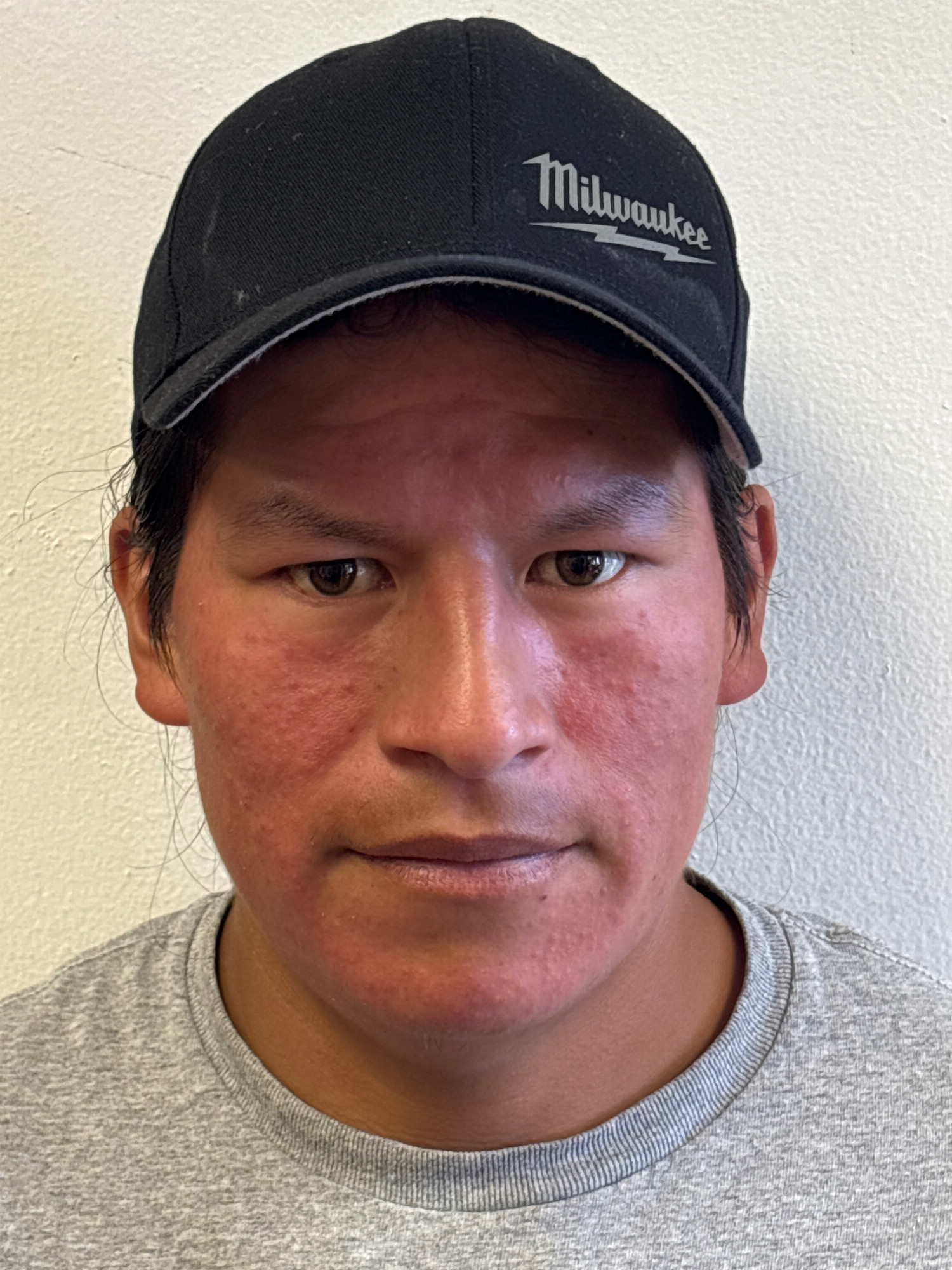 ANGEL FAVIAN LIMA MEDINA