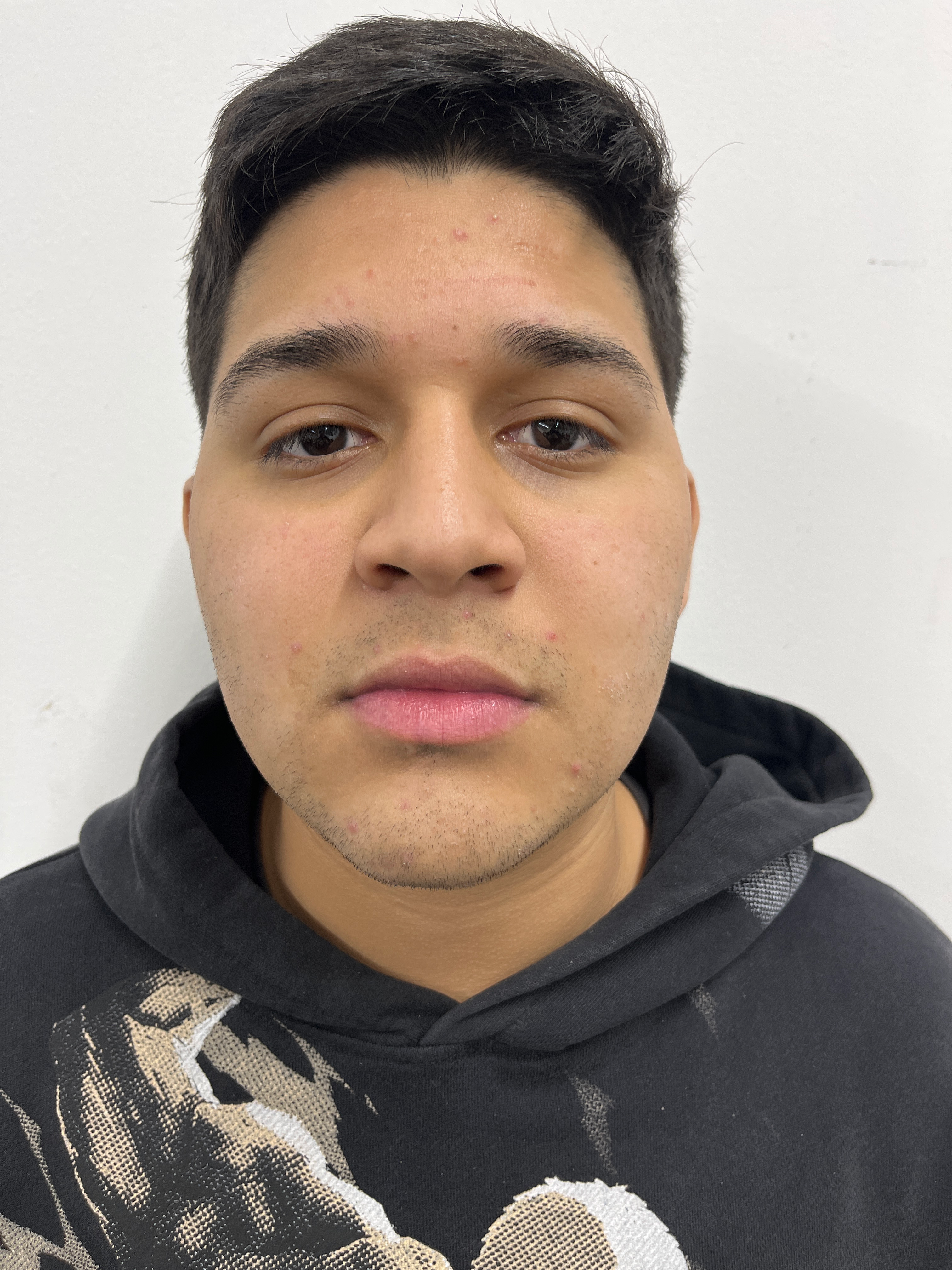 ANTHONY NAHUM IZAGUIRRE AGUILERA